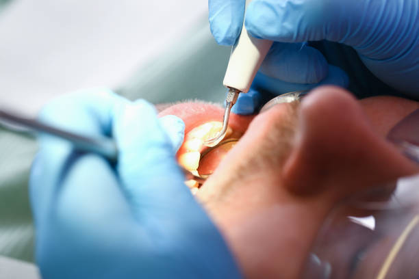 Best Tooth Infection Emergency Dentist  in Erwin, NC
